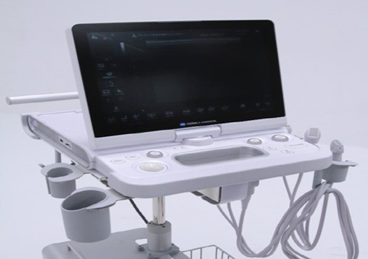 超音波診断装置